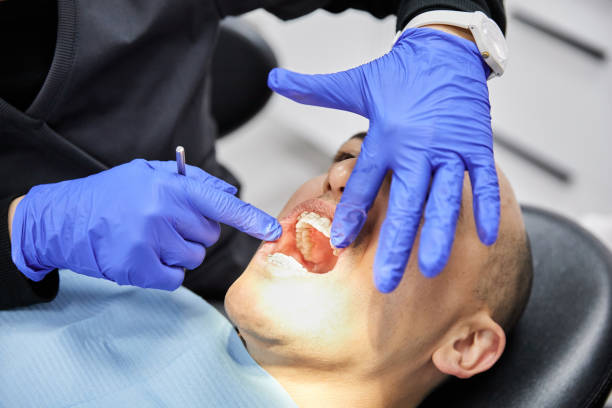 Best After-Hours Dental Trauma Care in Creswell, OR
